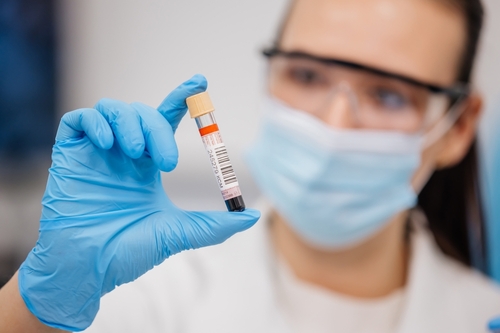 A,Female,Laboratory,Assistant,Conducts,An,Experiment,In,A,Scientific Medical professional holding a blood sample in a laboratory